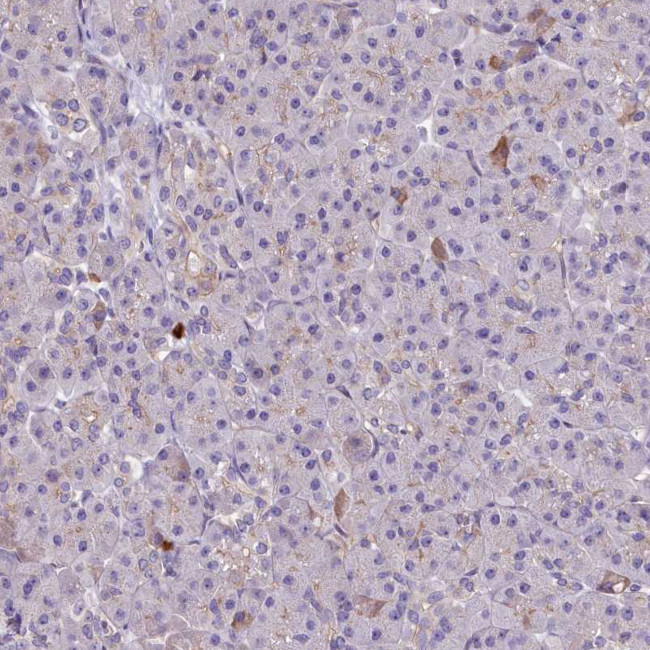 HLA-DOA Antibody in Immunohistochemistry (Paraffin) (IHC (P))