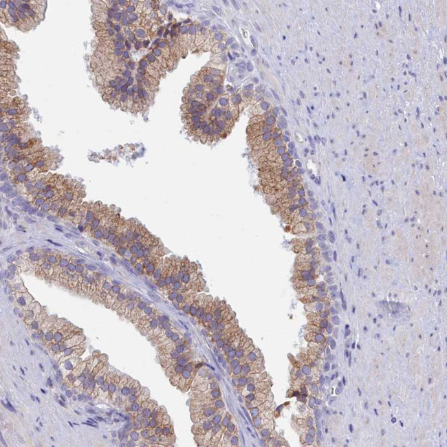 HM13 Antibody in Immunohistochemistry (Paraffin) (IHC (P))