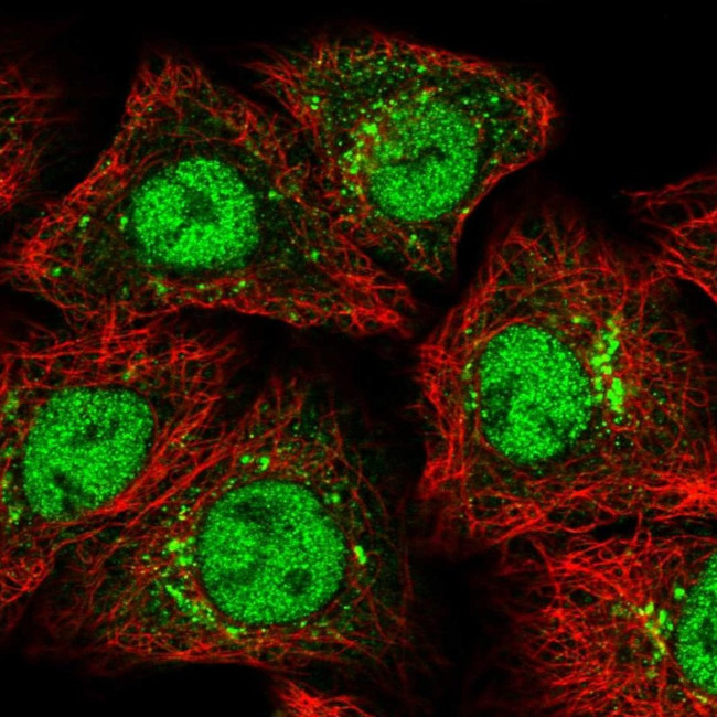 ZMIZ1 Antibody in Immunocytochemistry (ICC/IF)