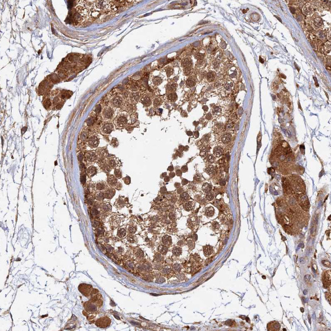 UBE2W Antibody in Immunohistochemistry (Paraffin) (IHC (P))