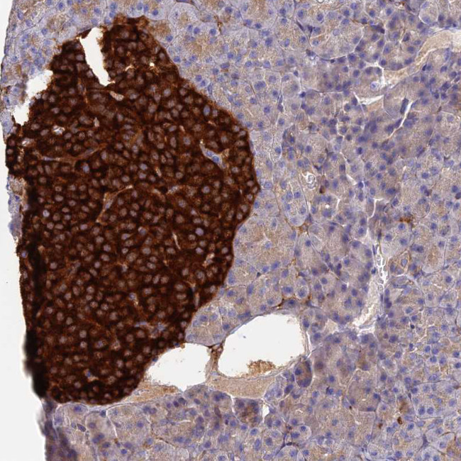 VAT1 Antibody in Immunohistochemistry (Paraffin) (IHC (P))