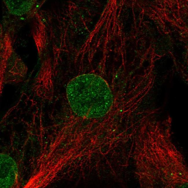 GDF6 Antibody in Immunocytochemistry (ICC/IF)