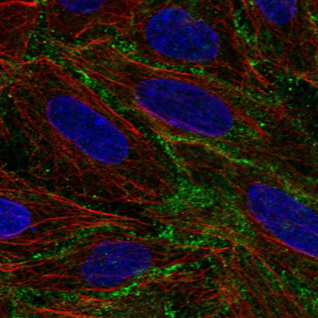 BASP1 Antibody in Immunocytochemistry (ICC/IF)