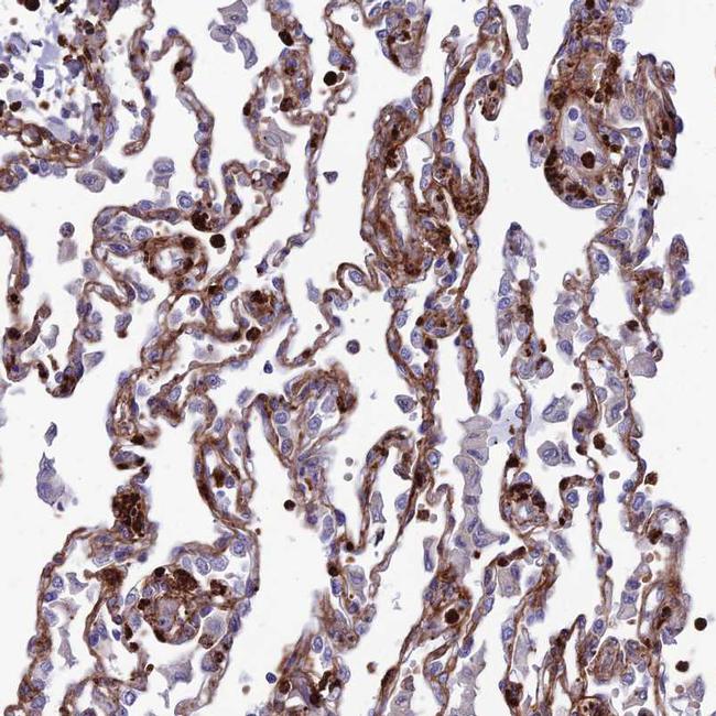 COL6A6 Antibody in Immunohistochemistry (IHC)