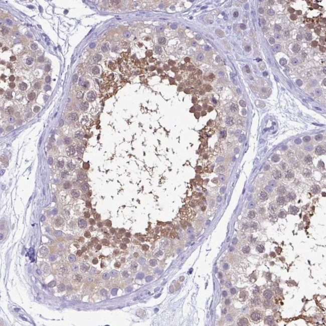 LDHC Antibody in Immunohistochemistry (Paraffin) (IHC (P))