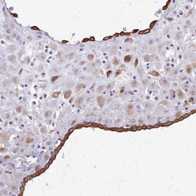 DSPG3 Antibody in Immunohistochemistry (Paraffin) (IHC (P))