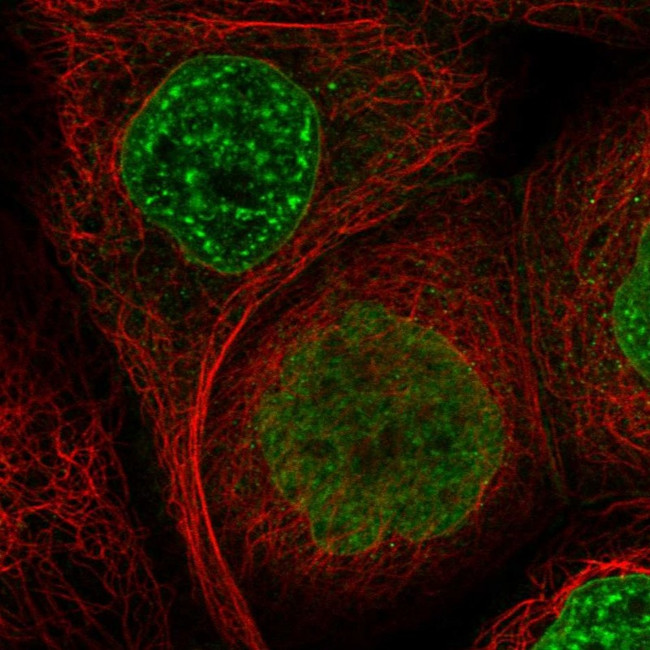 SIPA1L3 Antibody in Immunocytochemistry (ICC/IF)