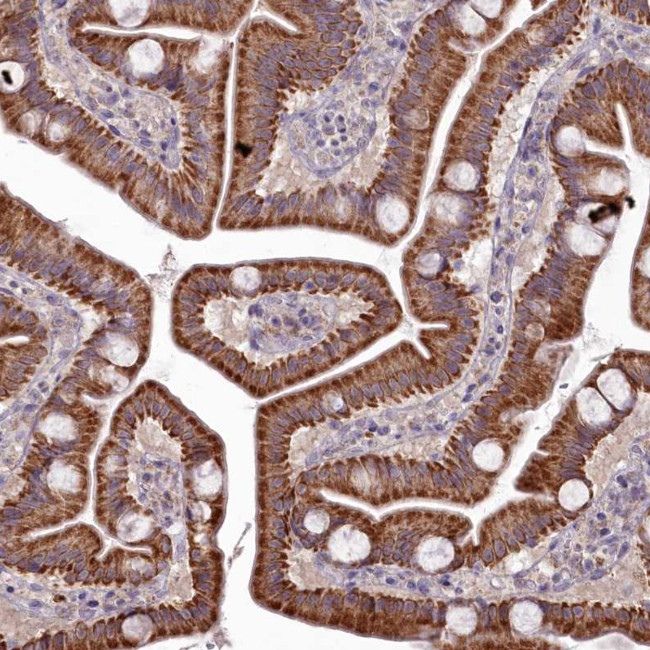 EFHA1 Antibody in Immunohistochemistry (Paraffin) (IHC (P))