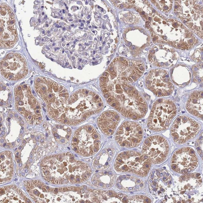 4E-BP3 Antibody in Immunohistochemistry (Paraffin) (IHC (P))