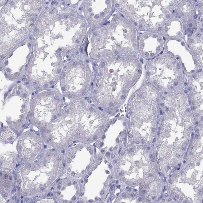 IL17REL Antibody in Immunohistochemistry (Paraffin) (IHC (P))