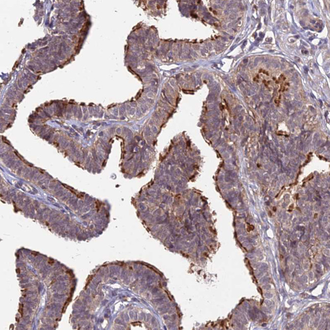 MINT3 Antibody in Immunohistochemistry (Paraffin) (IHC (P))