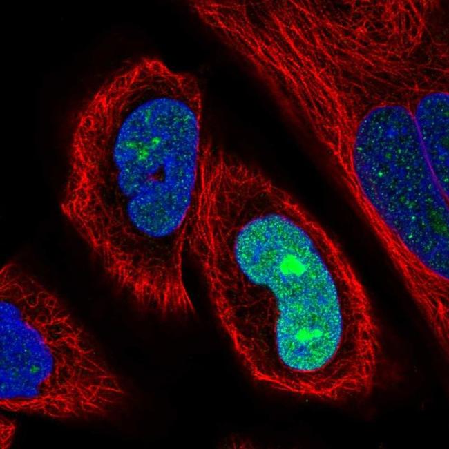 SSX1 Antibody in Immunocytochemistry (ICC/IF)