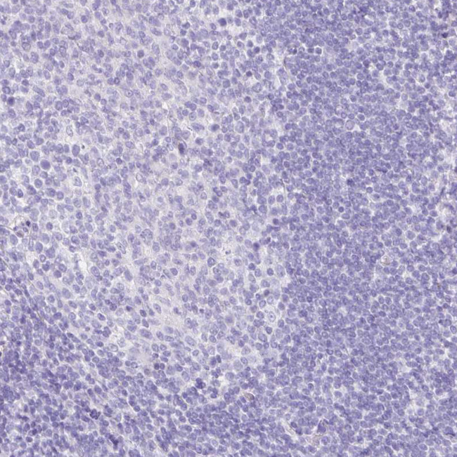 HAPLN2 Antibody in Immunohistochemistry (Paraffin) (IHC (P))