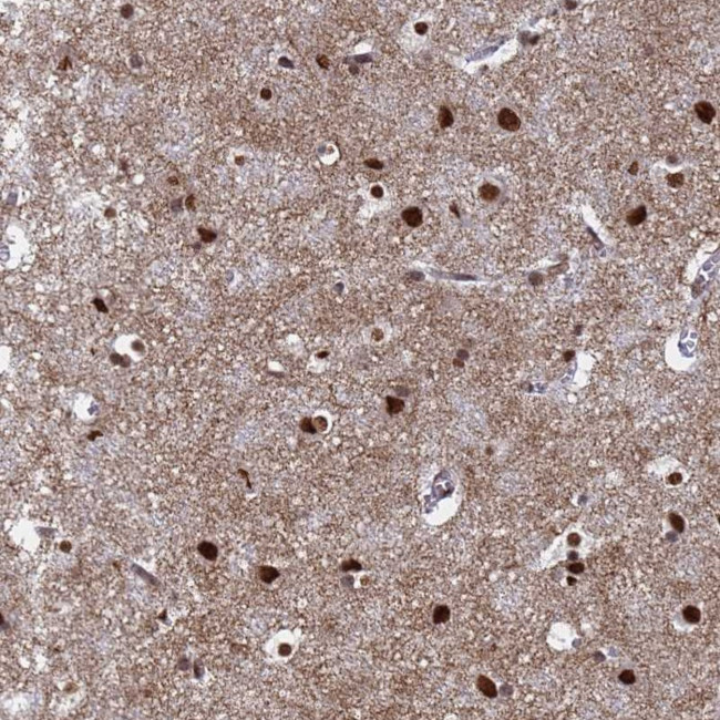 RAVER2 Antibody in Immunohistochemistry (Paraffin) (IHC (P))