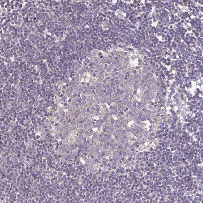 Desmoplakin Antibody in Immunohistochemistry (Paraffin) (IHC (P))