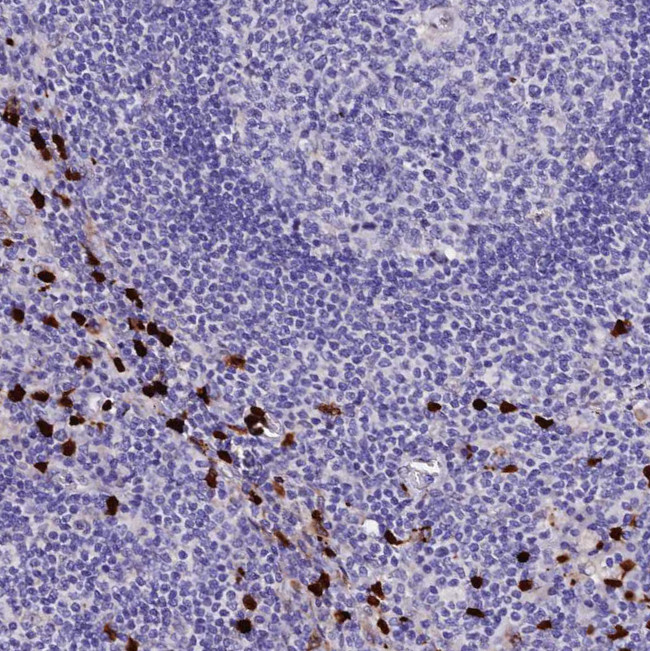 MCM10 Antibody in Immunohistochemistry (Paraffin) (IHC (P))