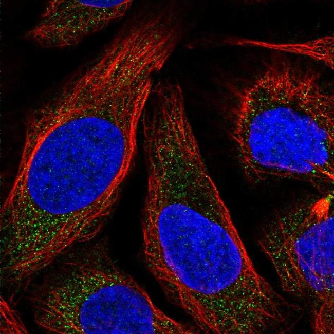 NKB Antibody in Immunocytochemistry (ICC/IF)