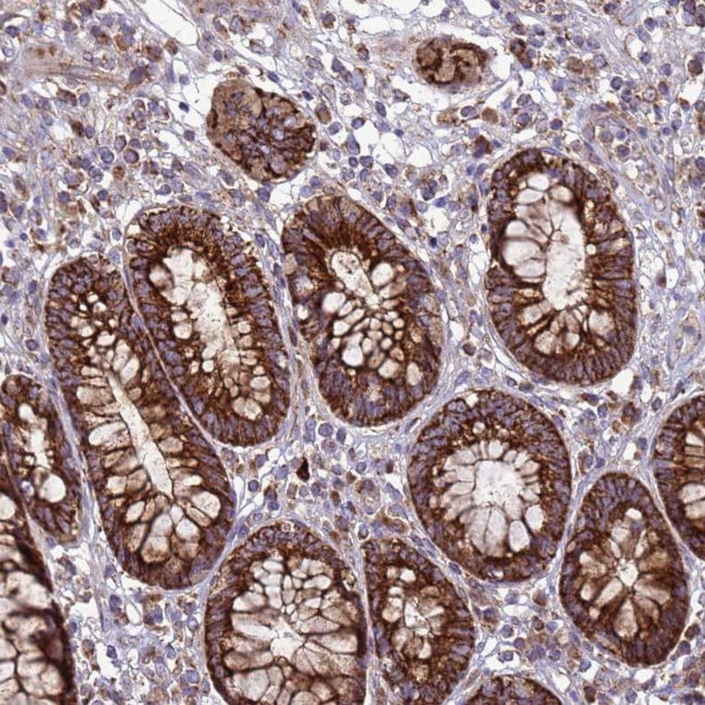 FSTL4 Antibody in Immunohistochemistry (Paraffin) (IHC (P))