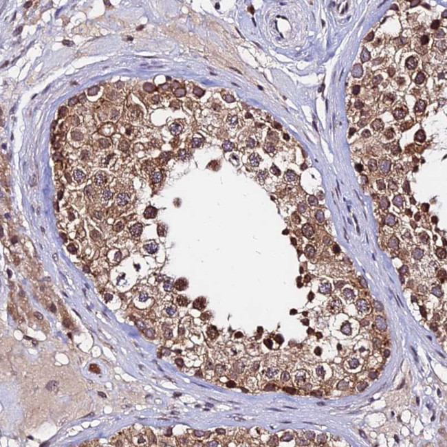 RNF121 Antibody in Immunohistochemistry (Paraffin) (IHC (P))