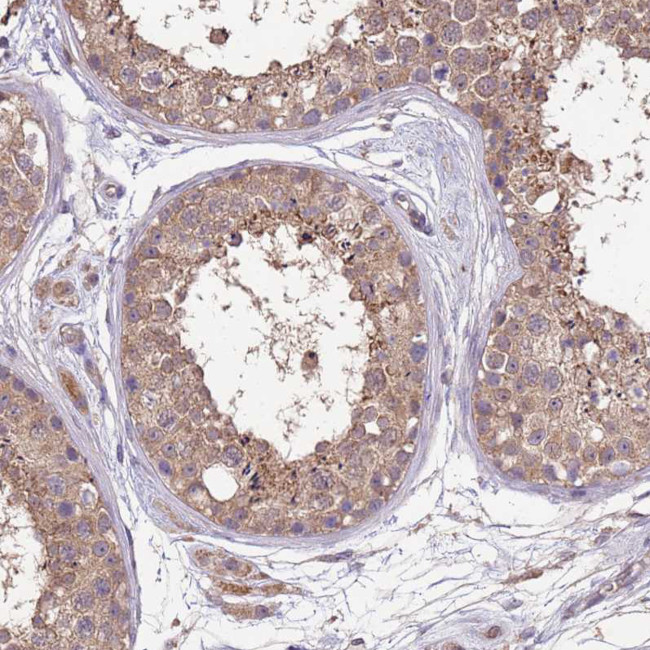 NPHP1 Antibody in Immunohistochemistry (Paraffin) (IHC (P))