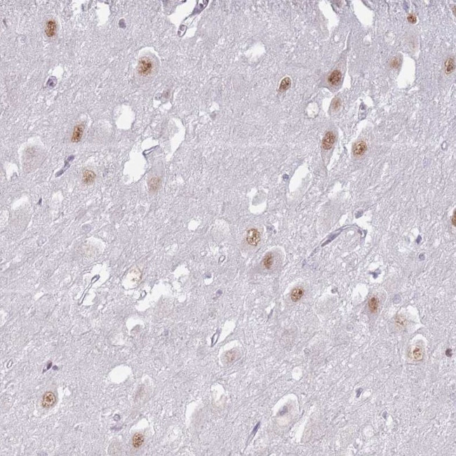 PTCHD1 Antibody in Immunohistochemistry (Paraffin) (IHC (P))