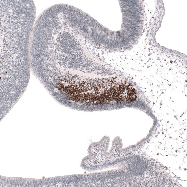 SKOR2 Antibody in Immunohistochemistry (IHC)