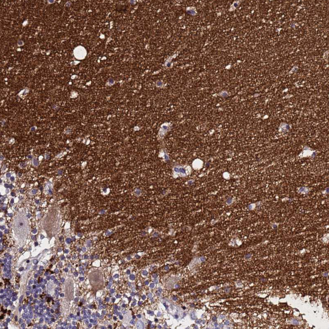 SV2B Antibody in Immunohistochemistry (Paraffin) (IHC (P))