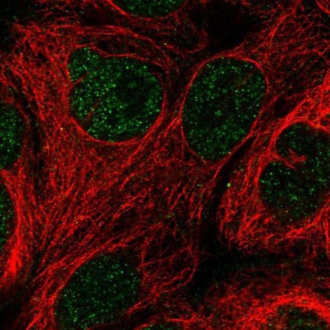 GCHFR Antibody in Immunocytochemistry (ICC/IF)