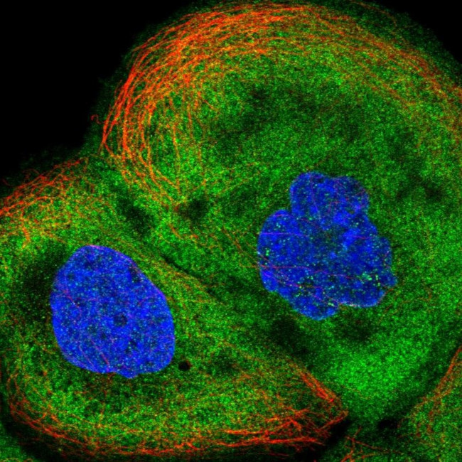 ALDH1A3 Antibody in Immunocytochemistry (ICC/IF)