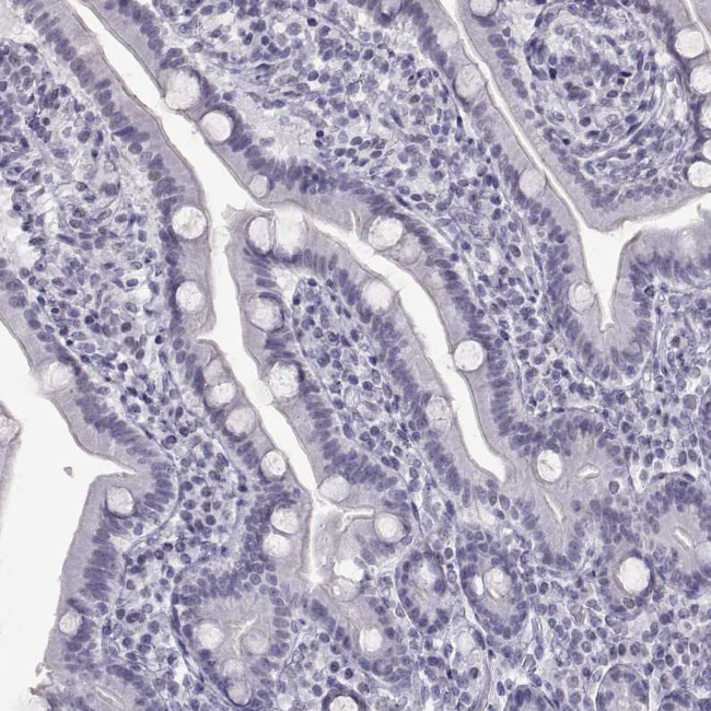 CARTPT Antibody in Immunohistochemistry (Paraffin) (IHC (P))