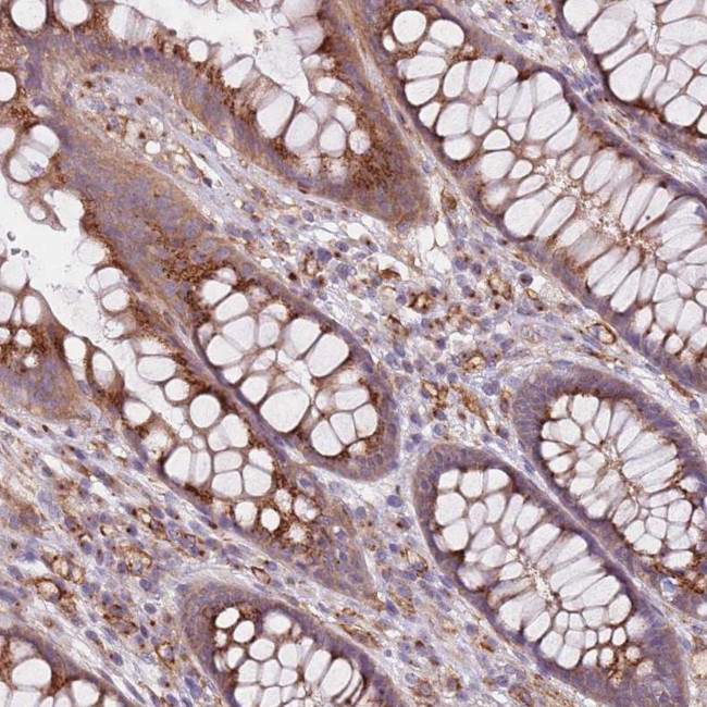 AKTIP Antibody in Immunohistochemistry (Paraffin) (IHC (P))