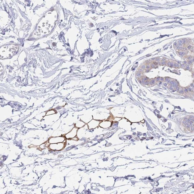 GPAM Antibody in Immunohistochemistry (Paraffin) (IHC (P))