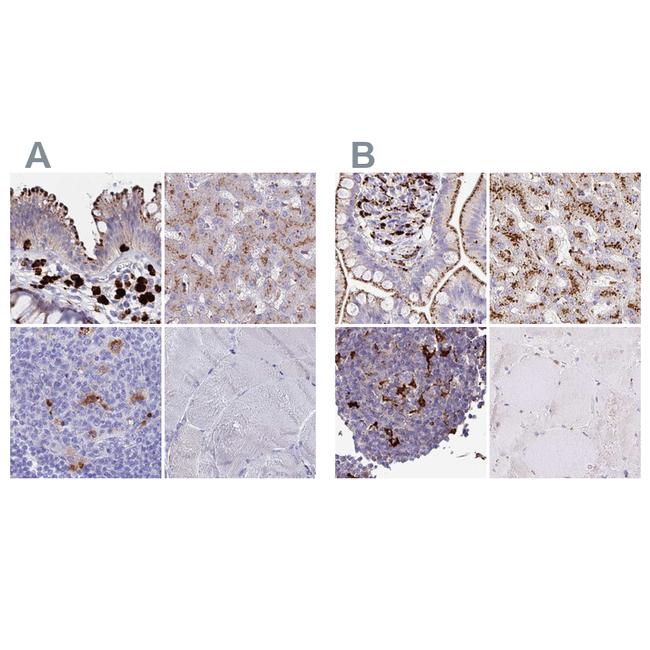 FUCA1 Antibody in Immunohistochemistry (IHC)