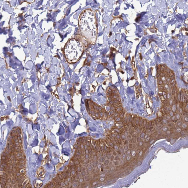 CNOT1 Antibody in Immunohistochemistry (Paraffin) (IHC (P))