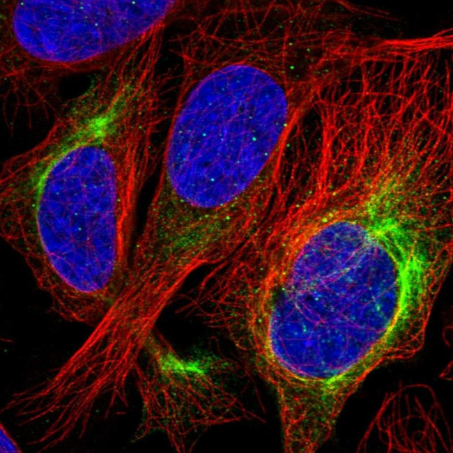 Alsin Antibody in Immunocytochemistry (ICC/IF)