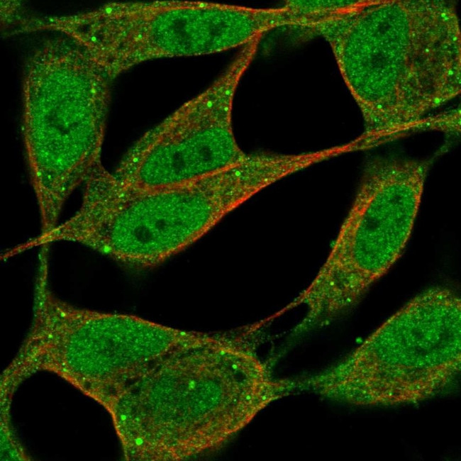 ZFPM1 Antibody in Immunocytochemistry (ICC/IF)