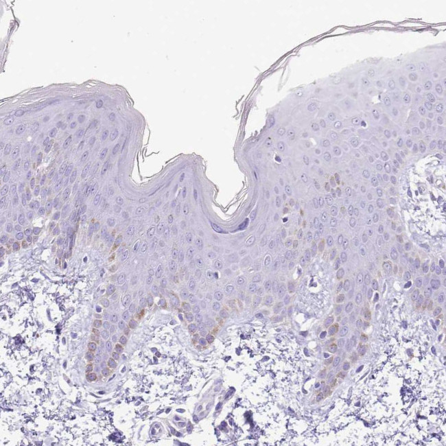 SCAMP5 Antibody in Immunohistochemistry (Paraffin) (IHC (P))