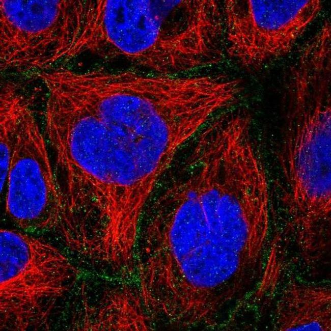 FLVCR1 Antibody in Immunocytochemistry (ICC/IF)