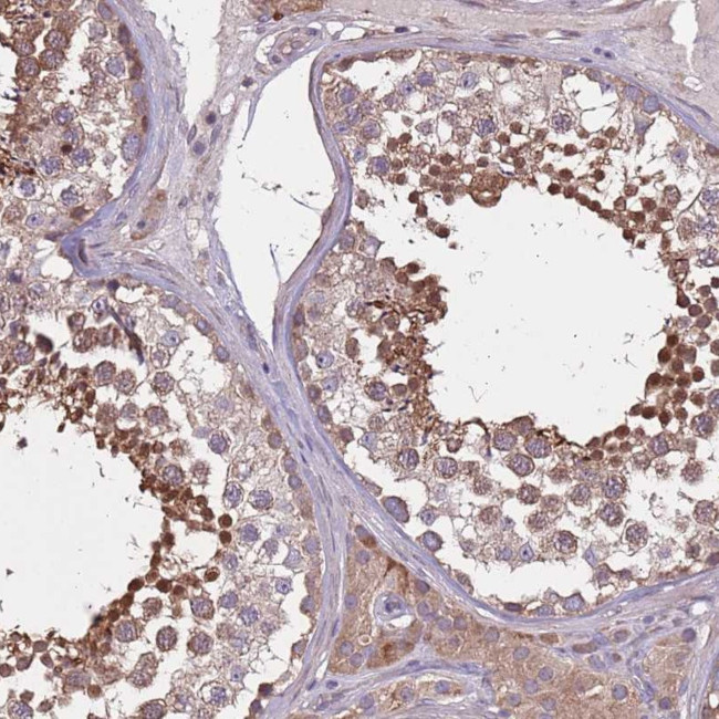 MBD3L1 Antibody in Immunohistochemistry (Paraffin) (IHC (P))