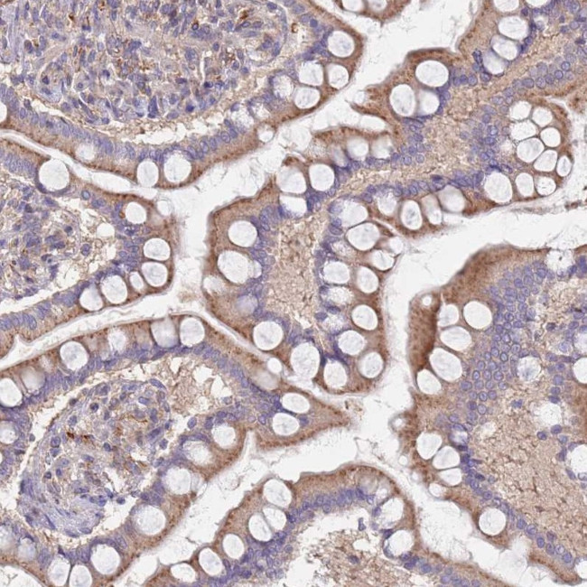 MALRD1 Antibody in Immunohistochemistry (Paraffin) (IHC (P))