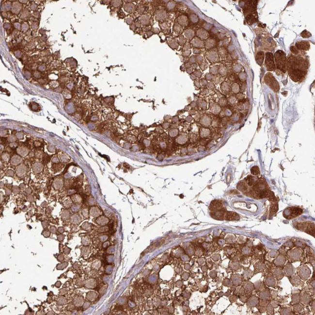 GNPDA2 Antibody in Immunohistochemistry (Paraffin) (IHC (P))