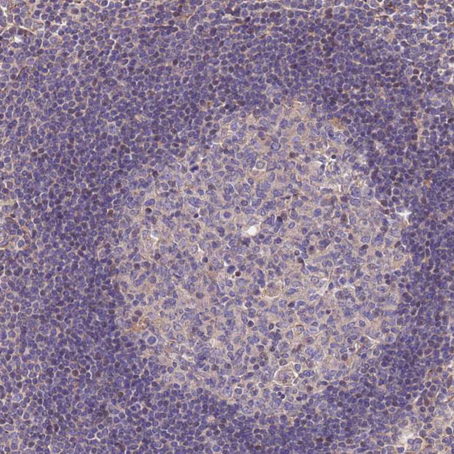 FAM89B Antibody in Immunohistochemistry (Paraffin) (IHC (P))