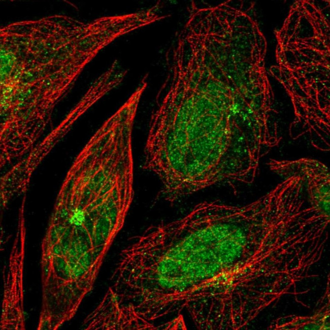 RPP25 Antibody in Immunocytochemistry (ICC/IF)