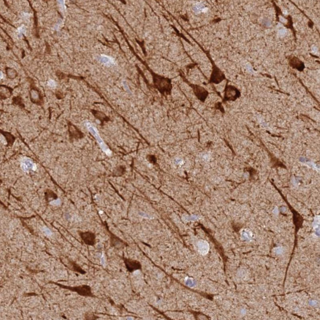 MCCD1 Antibody in Immunohistochemistry (Paraffin) (IHC (P))