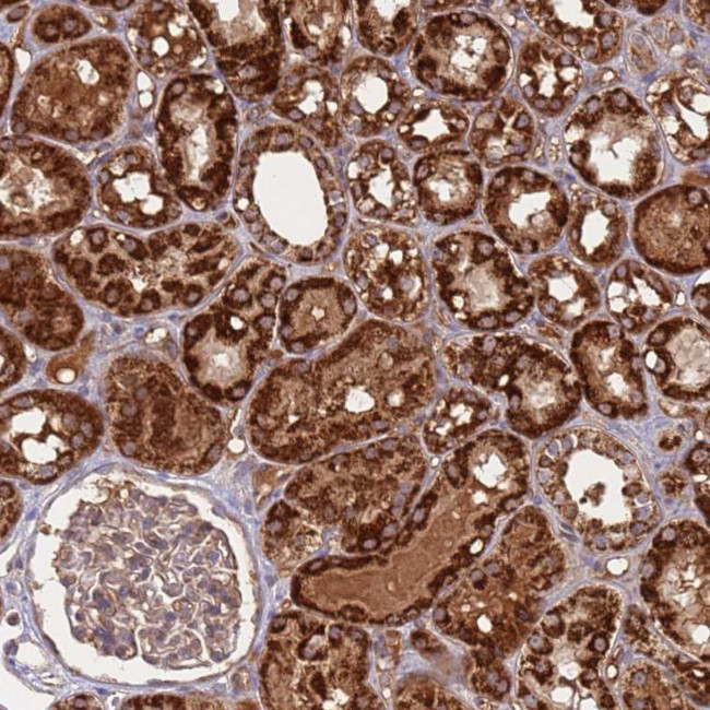 ATP5S Antibody in Immunohistochemistry (Paraffin) (IHC (P))