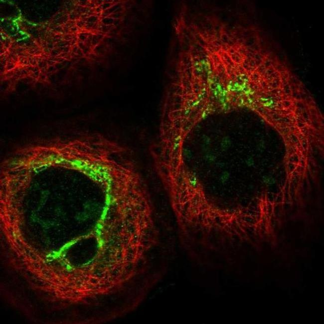 SNAPAP Antibody in Immunocytochemistry (ICC/IF)