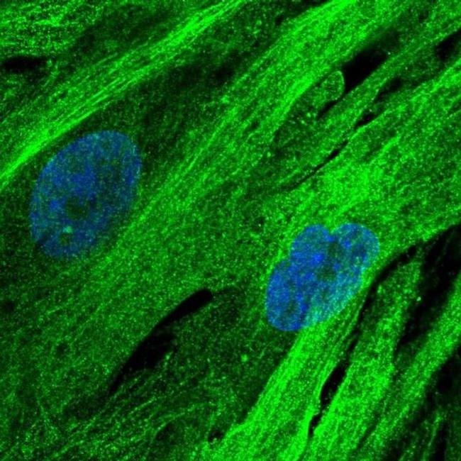 SLC16A4 Antibody in Immunocytochemistry (ICC/IF)