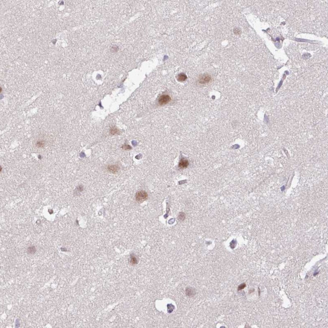 Arp3 Antibody in Immunohistochemistry (Paraffin) (IHC (P))