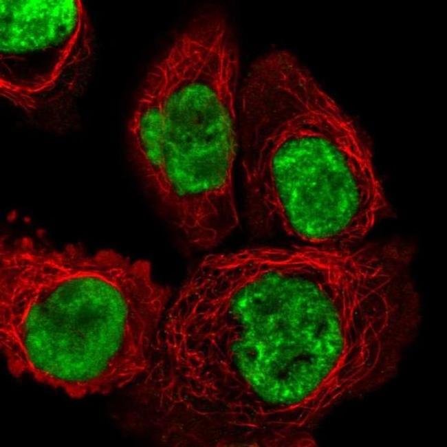 DHX15 Antibody in Immunocytochemistry (ICC/IF)