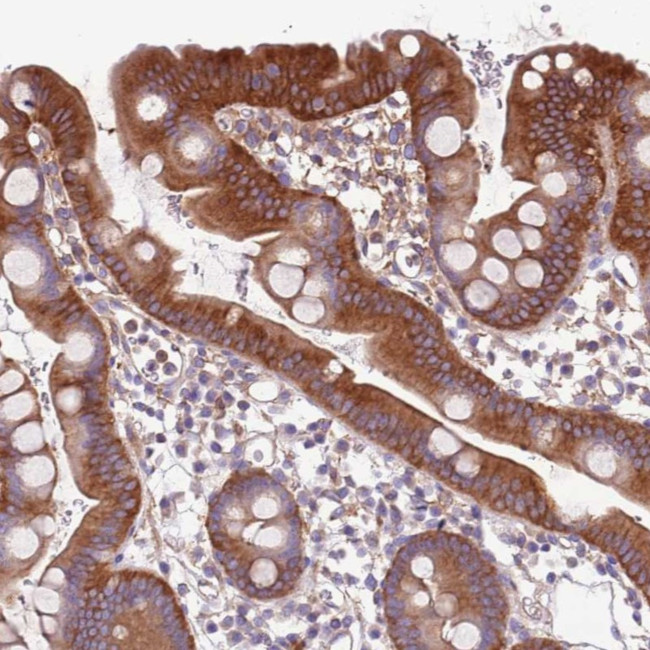 NAALADL1 Antibody in Immunohistochemistry (Paraffin) (IHC (P))